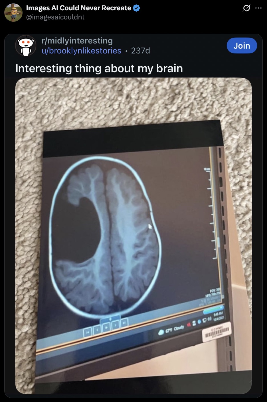 We all have that, don't worry